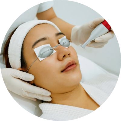 treatment - Laser Nd Yag C plus